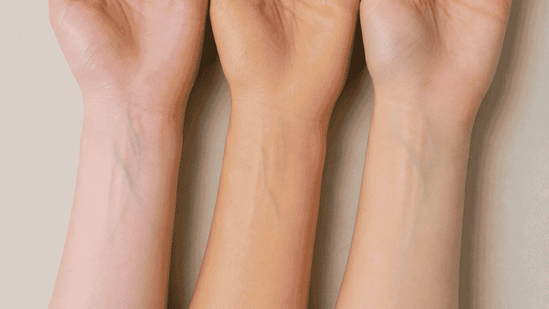 Three arm swatches side by side showing cool warm and neutral undertone skin differences for foundation matching