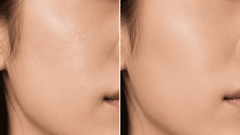 Side by side skin comparison showing sheer tinted moisturizer coverage versus fuller foundation coverage on the same skin tone