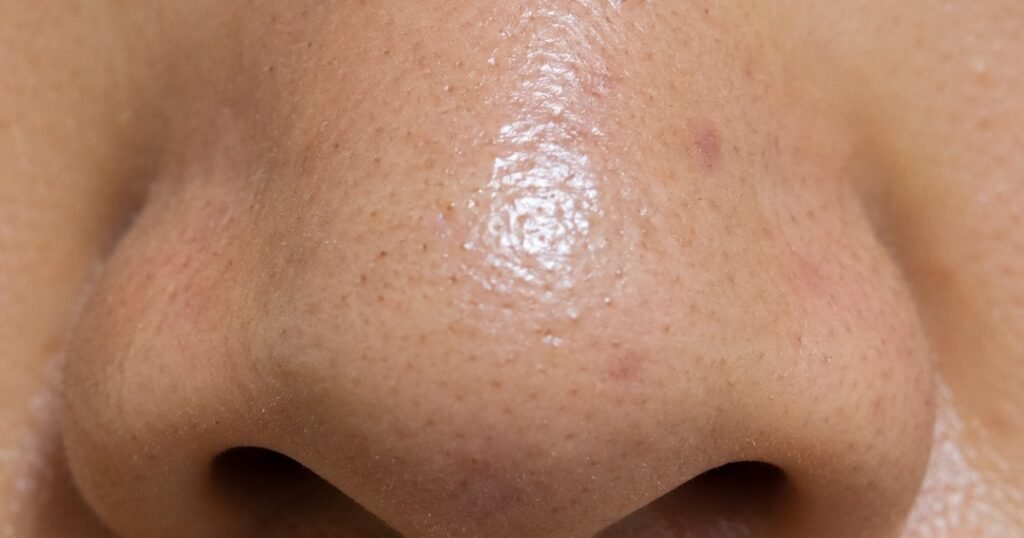 Close-up of nose area showing enlarged visible pores on oily skin before treatment or primer application