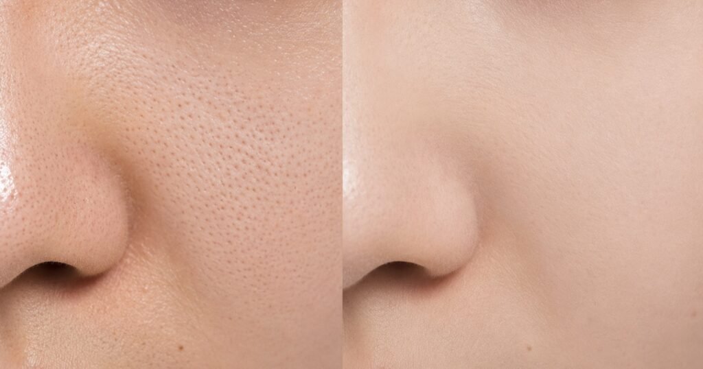Split comparison showing visible pores before primer and matte powder versus smooth blurred skin after correct pore-minimizing makeup technique
